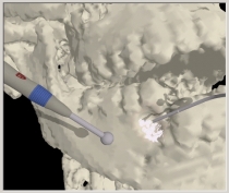 image of craniofacial surgical simulator with bone dust simulation
