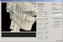 image of craniofacial surgical simulation with gui