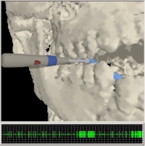 image of craniofacial surgical simulation with neurophysiology monitor
